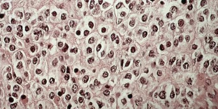 High Number of Mutations Means Better Cancer Survival Rate