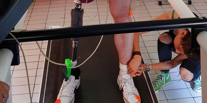 The Bionic Leg: Merging Man with Machine