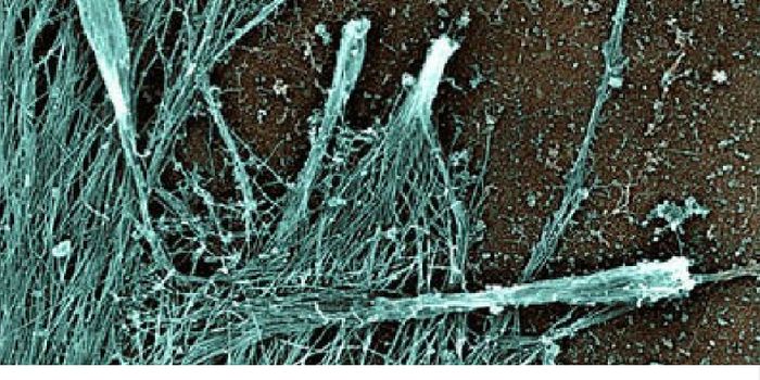 Scientists are Breaking Cancer's 'Legs'