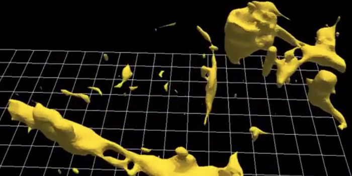 Melanoma Captured in Action