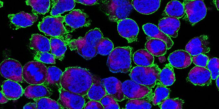 Researchers Learn How Sugar Boosts Inflammation