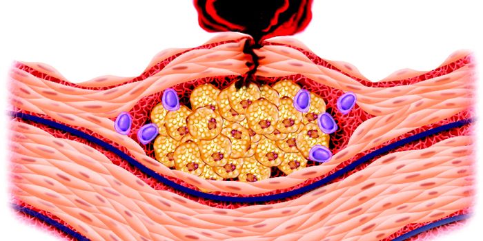 Detecting Early Signs of Atherosclerotic Inflammation