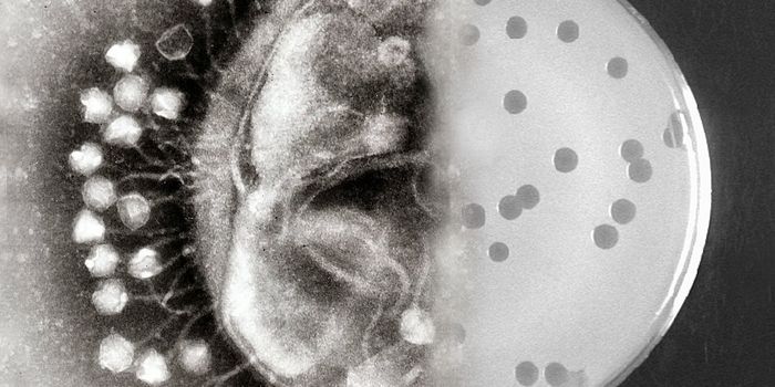 A promising treatment for chronic lung infection in cystic fibrosis