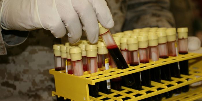 Cholera is More Deadly to Those with Type O Blood