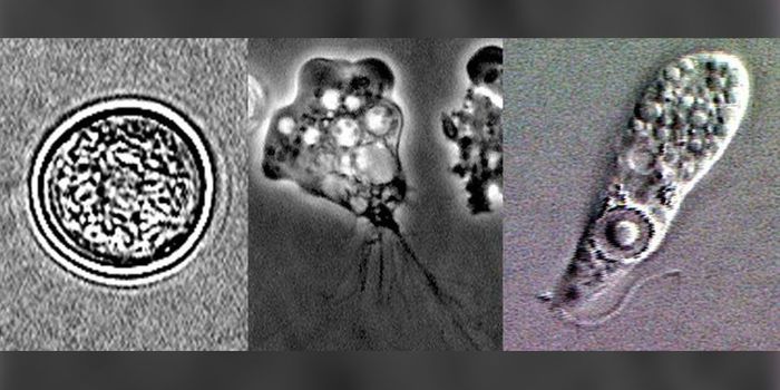 Diagnosed: Fourth Patient Infected with Brain-Eating Amoeba