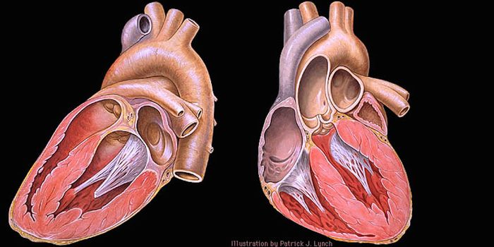 Pouch in Heart's Left Atrium Could Cause Strokes