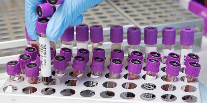 Autoantibodies Predict Multiple Sclerosis Years in Advance