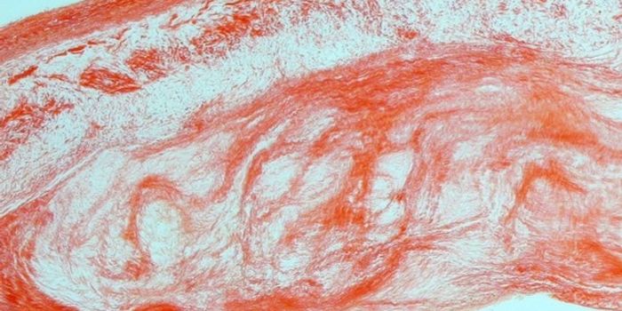 Dogs Get Heart Disease Too