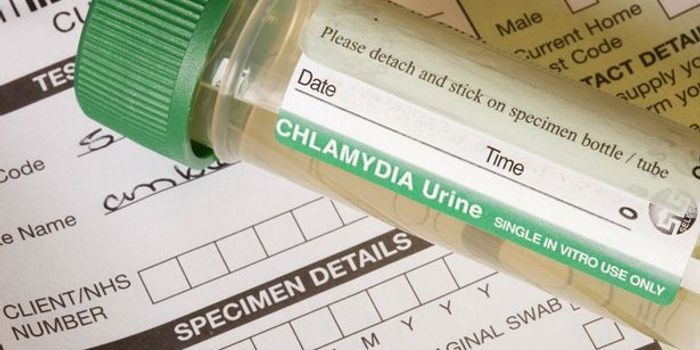 Prototype Vaccine Against Chlamydia Successful in Mice