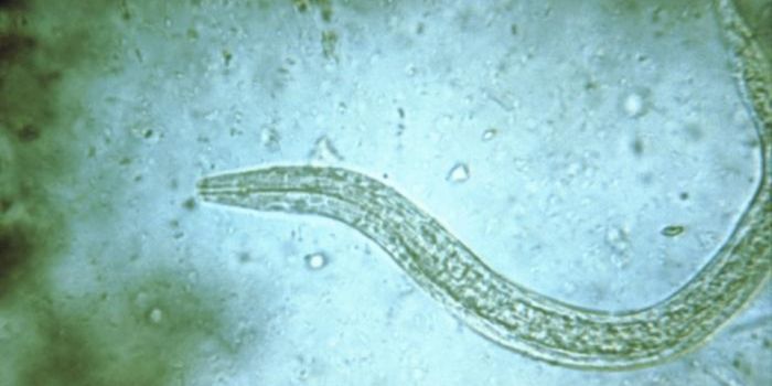 The Next Step Treatment for Hookworm Infections