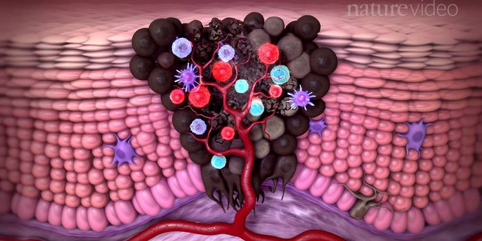 Immunotherapy for Cancer: Battle of the Cells