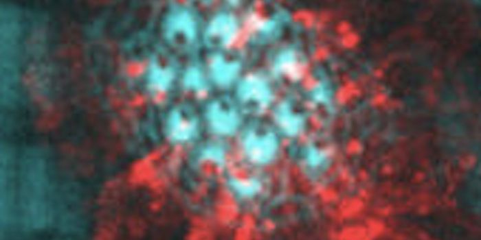 Zebrafish Help Researchers Learn More About Hearing