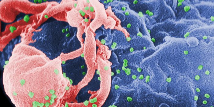 Q&A with Immunologist Steven A. Porcelli, MD: He is working toward creating a more effective TB vaccine and one to protect from HIV