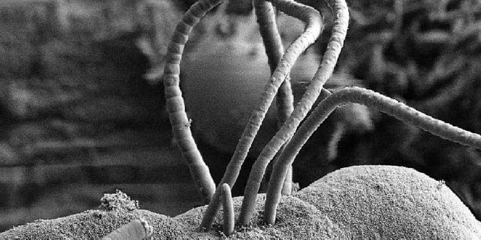 Better Know a Microbe: Segmented Filamentous Bacteria