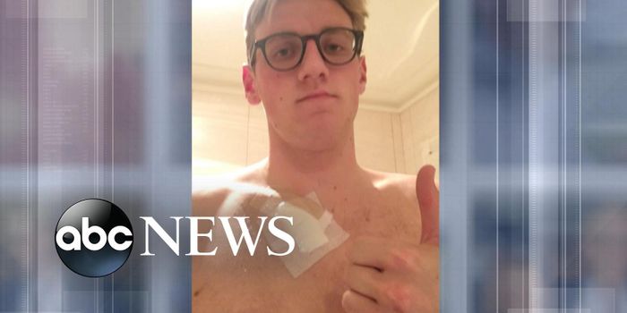 Possible Skin Cancer Spotted by Alert Fan