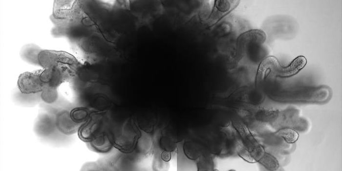 Lung Organoids are Similar to the Full-size Organ