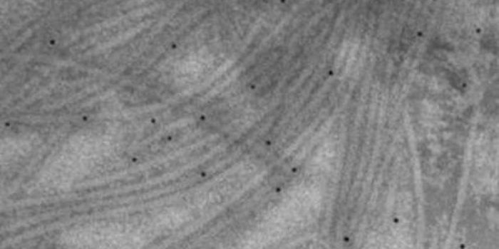 New Kind of Enzyme Helps Bacteria Infect Hosts