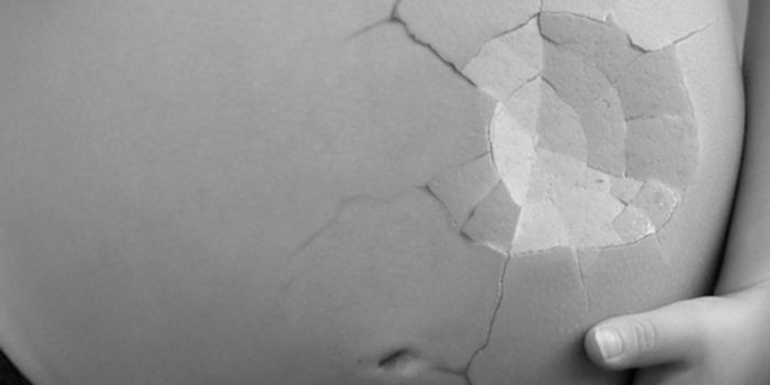 Can This Common Pain Reliever Cause Language Delays in Children?