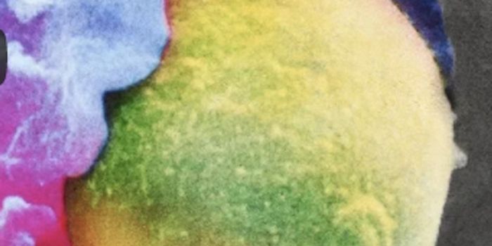 One Cell was Consumed by Another in a Evolutionary Leap