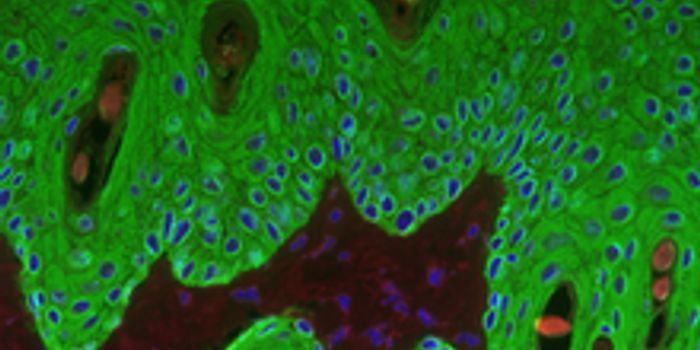 More is Revealed About the Cellular Process of Necroptosis