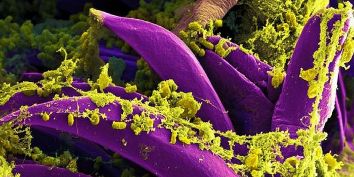 Gut Bacteria Linked to Chronic Fatigue Syndrome