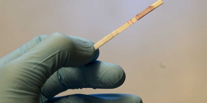 Scientists Develop Rapid Paper Strip Test for Detection of Resistant Bacteria