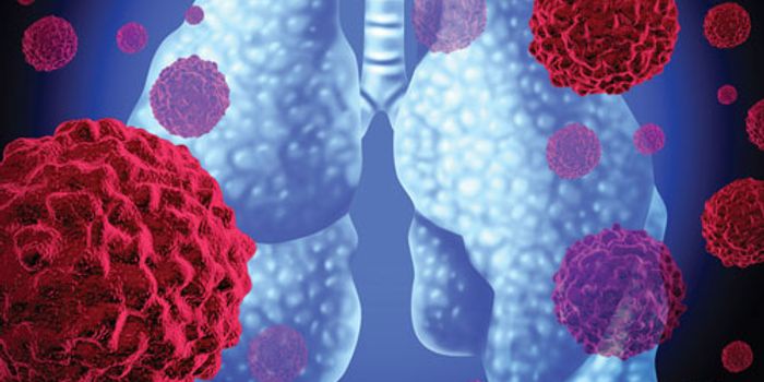 Two-Drug Strategy for Non-Small Cell Lung Cancer (NSCLC)