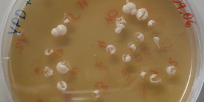 Unraveling the Causes of Aging Using a Yeast Model