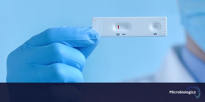 The Necessity of External Controls