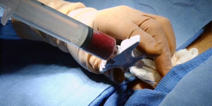 Bone Marrow Transplants without Toxic Chemotherapy