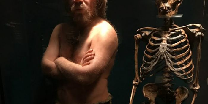Neanderthal Genes Risk Causing Toxicity with Common Drugs