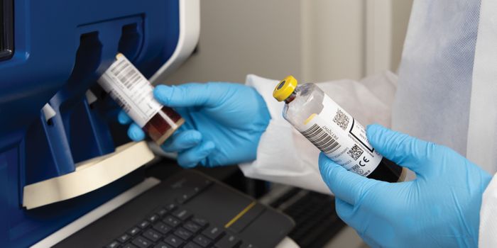 Bacterial Toxins and Advances in Detecting Bloodstream Infections