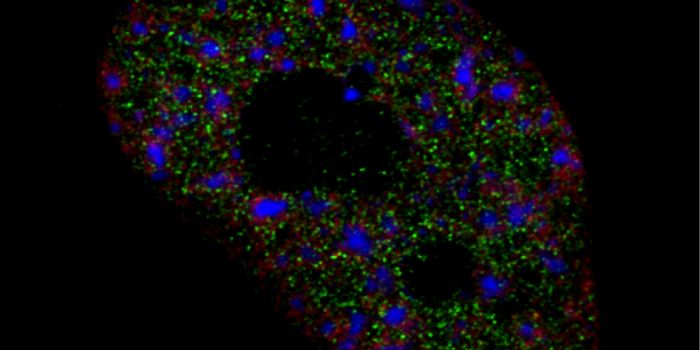 Mutation Allows Liver Cancer Cells to Escape Limbo