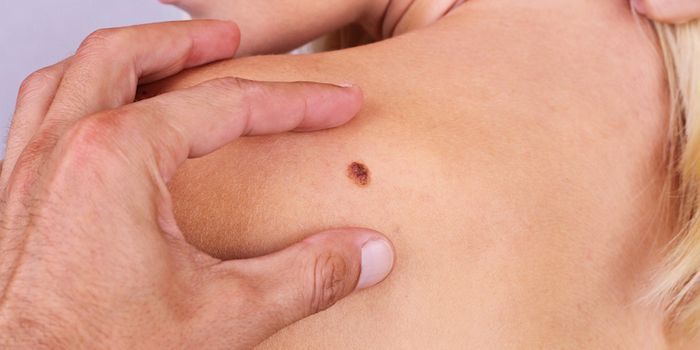 Humans and Man's Best Friend Share Genetic Mutations in Rare Form of Melanoma