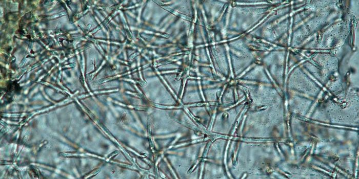 What does the world's oldest fungus tell us about evolution?