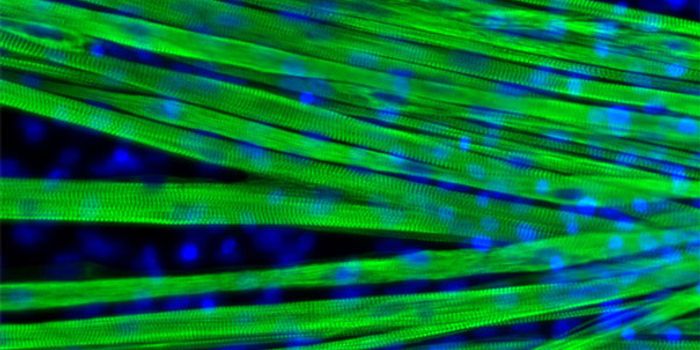 Making Muscles to Study Muscular Dystrophy