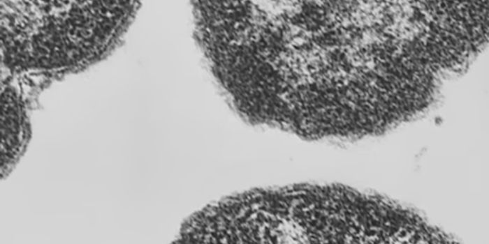 A New Target for an Effective Gonorrhea Treatment