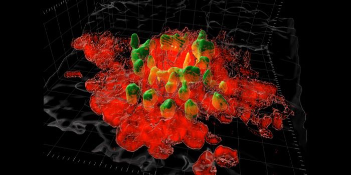 The Cause of Post-Surgical Scarring, Revealed