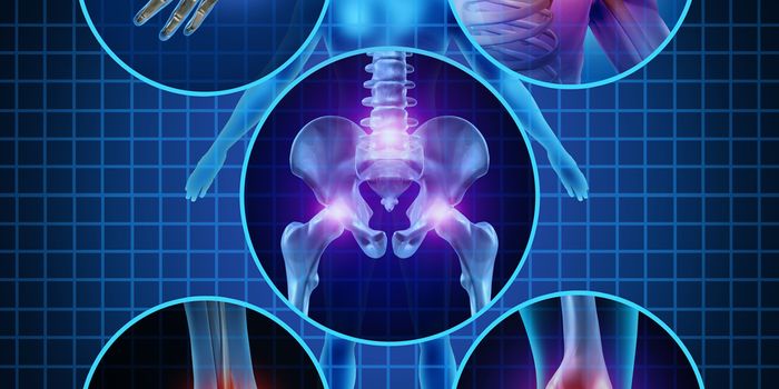 First Ever "Super Enhancers" Discovered in Autoimmune Disease