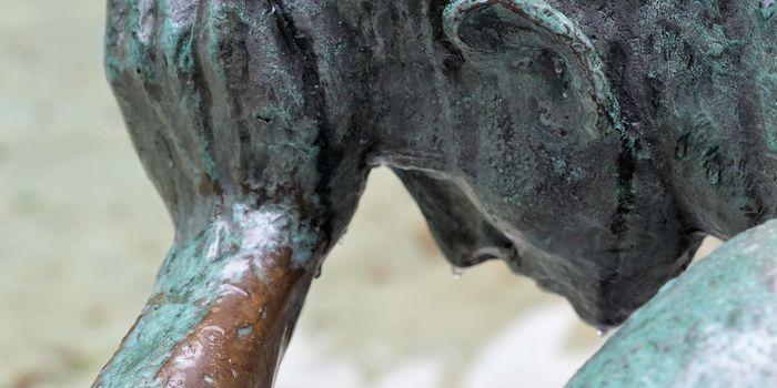 Proteins That Seem to Cause Migraines are Found