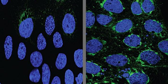 Protection from Zika Virus for A Defenseless Fetus