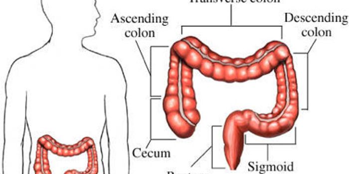 Tumor Location Predicts Survival Odds in Colon Cancer