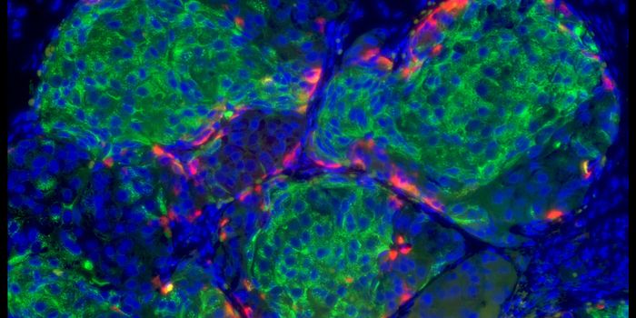 Protecting Beta Cells to Treat Type 1 Diabetes
