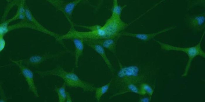 Aberrant mRNA Processing may Underlie Schizophrenia