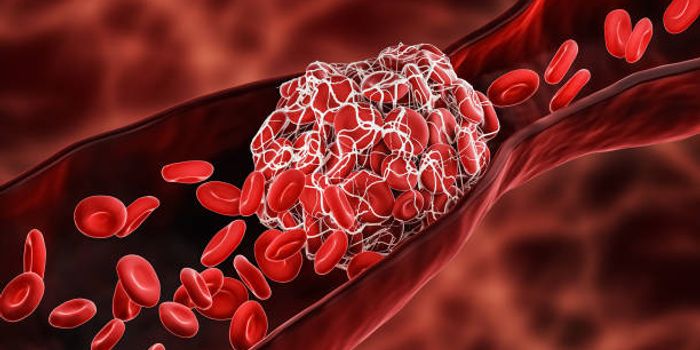 COVID-19 Increases Risk for Blood Clots and Bleeding Months after Infection
