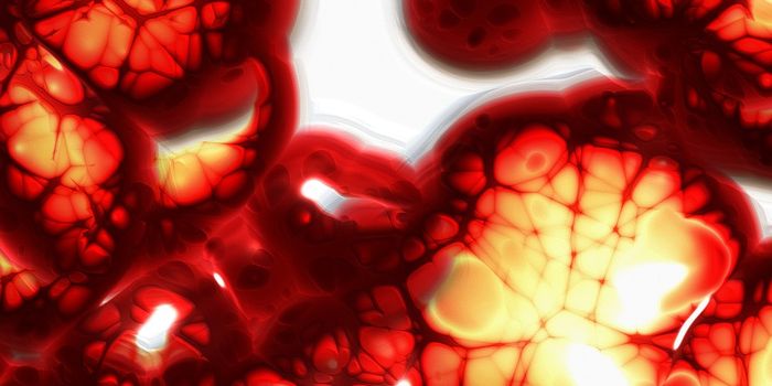 Identifying A Rare Autoimmune Disease at the Cellular Level