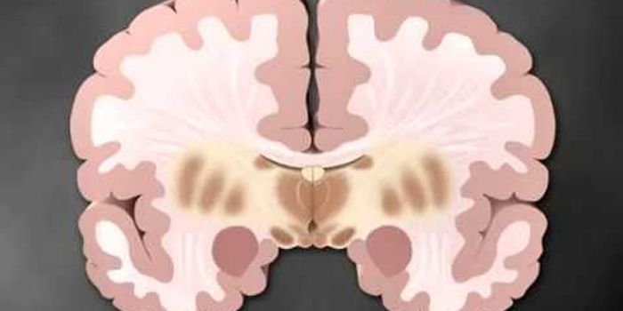 Mechanism of Parkinson's disease