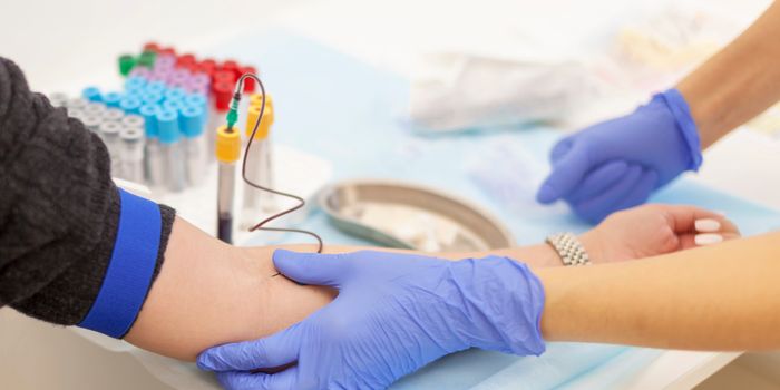 Digital PCR (dPCR) in oncology applications: when accurate counts really matter