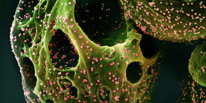 Organ Damage Continues for at Least a Year in 59% of Long COVID Patients