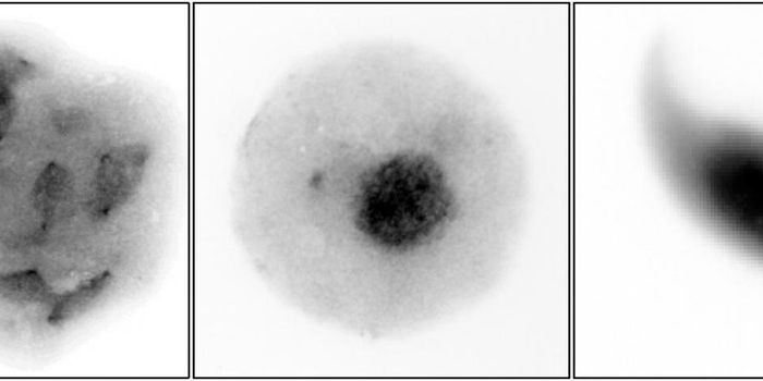 Sperm has to Get DNA Properly Packaged to Pass it to the Next Generation